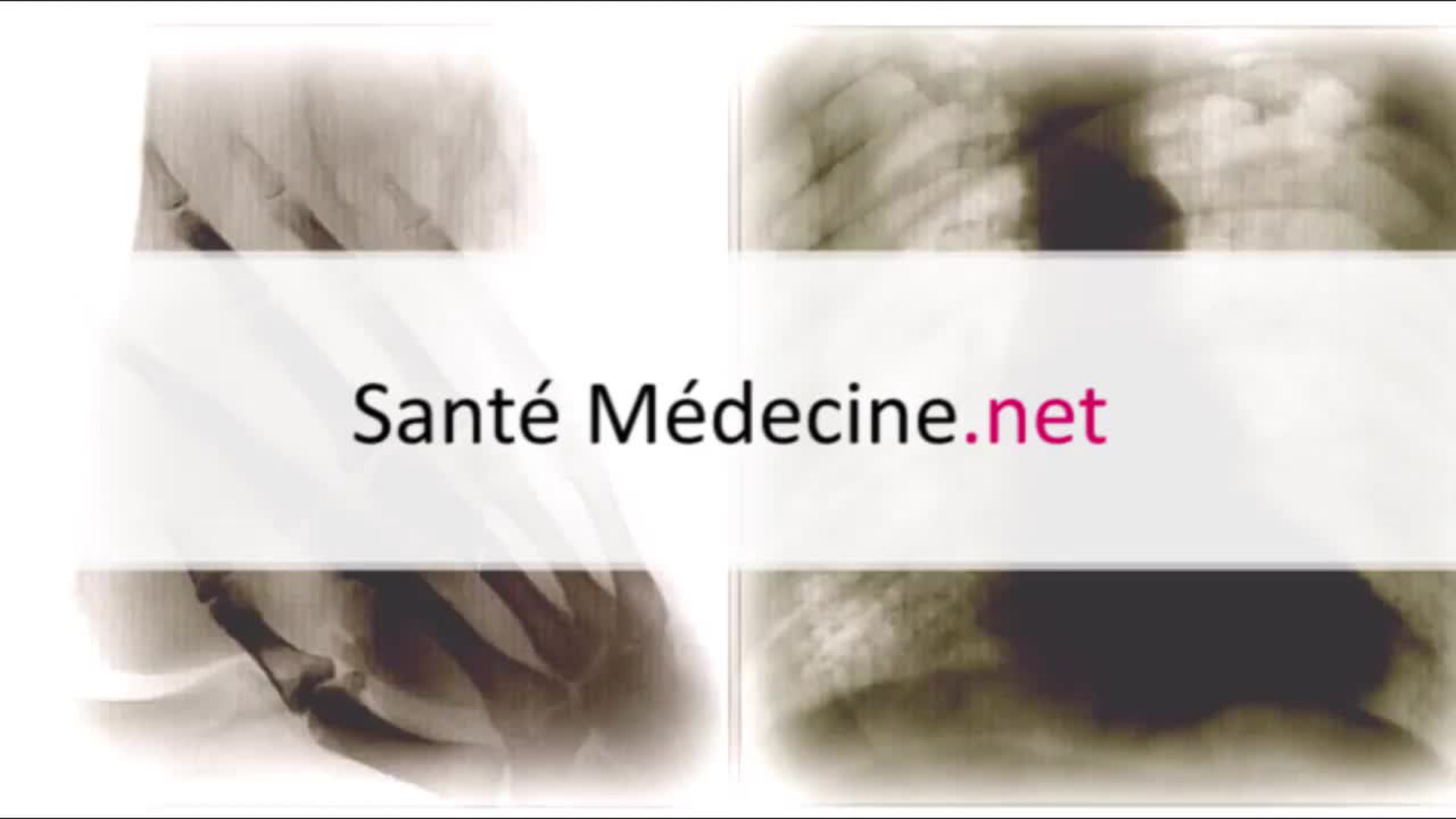 Saignement De Nez D Ou Vient Il Et Que Faire Pour L Arreter