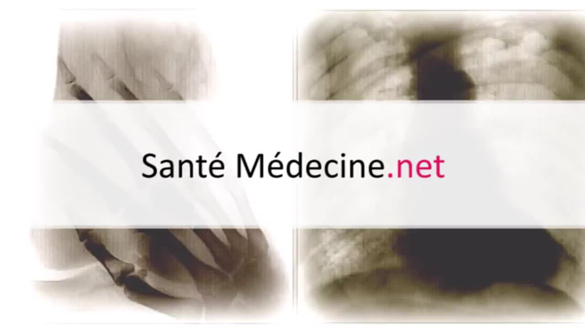 Aliment qui font aller au toilette